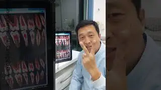 tratamento de canal, dentes dos fundos são mais difíceis?