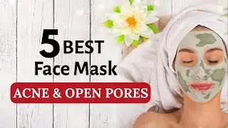5 Must-Have Face Masks for Oily Skin & Acne | Pore Tightening