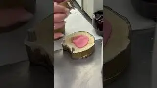 How to making comfortable esthetics dentures!