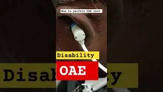 How to perform OAE test#bera