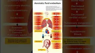 Amniotic fluid embolism