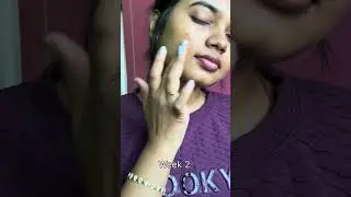 Best Serum for Acne Marks, Open Pores & Excess Oil | Proskire Niacinamide Serum