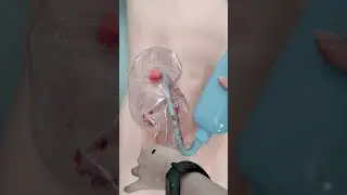 How to clean the one-piece ostomy bag