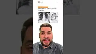 Isso pode cair na sua prova da USP-SP, UNICAMP ou ENAMED  ⚠️ Ent&atilde;o presta aten&ccedil;&atilde;o aqui!