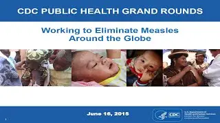 Working to Eliminate Measles Around the Globe