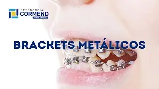 Brackets Met&aacute;licos Antofagasta - Cl&iacute;nica Dental Ortodoncia Cormend