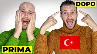 TRAPIANTO DI CAPELLI IN TURCHIA!?ECCO LA VERITA'!...