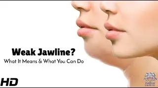 Fixing a Weak Jawline: Myths, Facts & Real Solutions