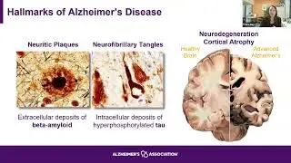 OLLI at Humboldt Brown Bag Lunch Presentation 9/15/25: Latest in Alzheimer&rsquo;s & Dementia Research