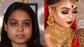 How to Get Rid of Birthmarks With Makeup | Best Bengali Bridal look | Makeup Artist Dipanwita