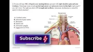 Он жаловался на руку, а проблема была в легком || Pancoast Tumor на USMLE Step 1