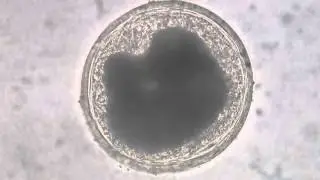 Encysted Metacercaria from a Freshwater Mussel 40X