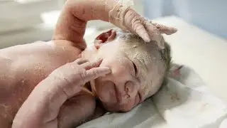 Newborn First Care After Birth 🩺| Cleaning Amniotic Fluid, Suction & Initial Assessment