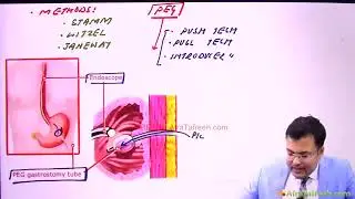 433 Nutrition | SURGERY |
