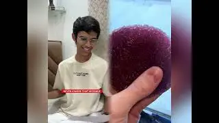 Funniest Fun Top New Comedy Video 2025🤣Amazing best of funny video #humor #fypシ #pov #fyp #foryou 😍😜