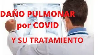 Daño pulmonar por covid y su tratamiento