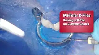 Dentsply K Files   Review by Dr  Scott Norton 720p