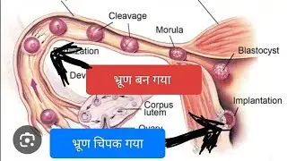 #iui के कितने दिन बाद प्रेगनेंसी होती है?