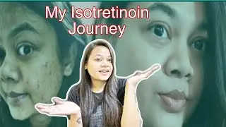 ISOTRETINOIN TABLETS Update after 1 Year | Does isotretinoin remove acne permanently?