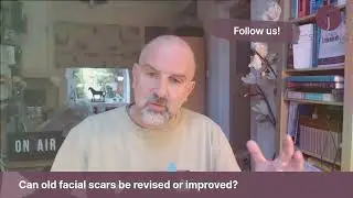 #AskJJ Can old facial scars be revised or improved?