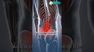 Can a Slip Disc Cause Neck Pain? | Disc Herniation & Nerve Compression Explained&rdquo;