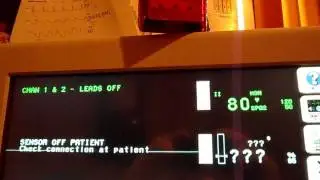 External alarm light for Spacelabs monitors (home made)
