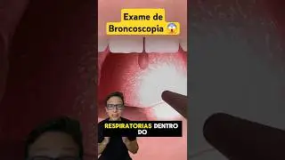Exame de Broncoscopia 😱 #medicina #medico #curiosidades #enfermagem #enfermeiro #pneumologista