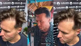 Kyle Christie From Geordie Shore SMP Testimonial At Hairlusion