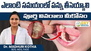 When To Remove Damage Teeth || Dr. Madhuri Kotha || Oxy Dental