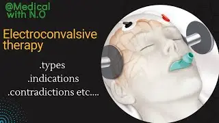 electroconvulsive therapy , TYPES,INDICATIONS, CONTRACTION #ECT #PSYCHIATRY #generalknowledge