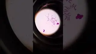 😱❗ &iquest;C&Oacute;MO se ven los CROMOSOMAS en tus C&Eacute;LULAS?