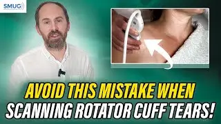 3 Common Mistakes to Avoid When Diagnosing Rotator Cuff Tears on Ultrasound! PART 01