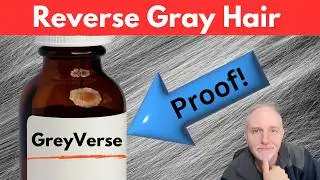 GreyVerse: Real Gray Hair Solution? Proof ‼️