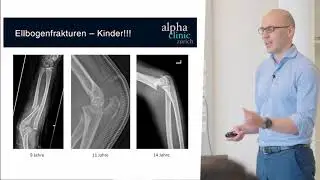 Sommersportverletzung Ellbogen