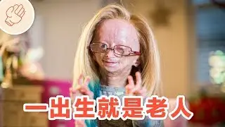 快速衰老的小女孩
