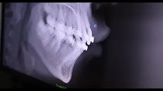 RADIOGRAF&Iacute;A CEFALOM&Eacute;TRICA 👨&zwj;⚕️