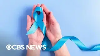 Colorectal cancer becomes biggest cause of cancer-related death for young Americans, study finds