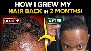MY HAIR GROWTH JOURNEY 