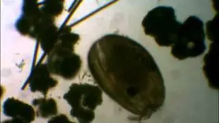 Unknown Organism Eating Microcystis Cyanobacteria