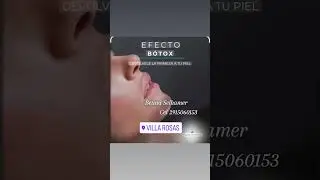 #villarosas #facialtreatment #est&eacute;tica #bahiablanca #depilacion #dermapen
