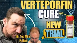 Verteporfin Hair Loss Cure Trial To Start 2025- Dr. Ted Miln UK