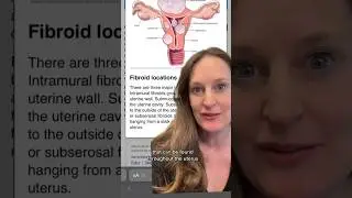 #fibroids #fertility