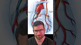 Coronary Anatomy: CABG vs PCI