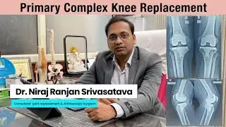 Primary Complex Knee Replacement