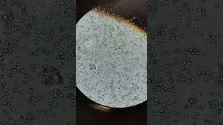 yeast under microscope