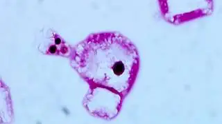 Clinical Mycology: Direct Examination Series: Crytococcus [Hot Topic]