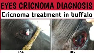 eyes cricnoma Diagnosis|carcinoma treatment|carcinoma surgery|carcinoma in hindi#cricnoma#treatmint