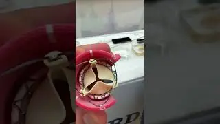 Протез Аортального клапана #врач