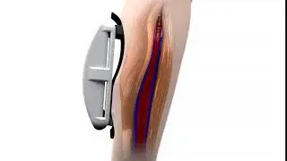 Venowave Circulation Booster