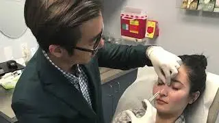 Dermal Fillers for Non-Surgical Rhinoplasty | Safe Nose Reshaping with Minimal Downtime